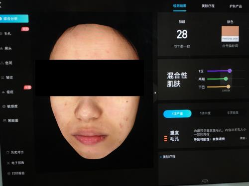 Which skin detector is stronger? Visia, Meitu Yishu, A-one measured